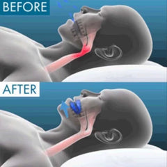 Snore Stopper – Sleep Deeper, Breathe Easier, Wake Refreshed